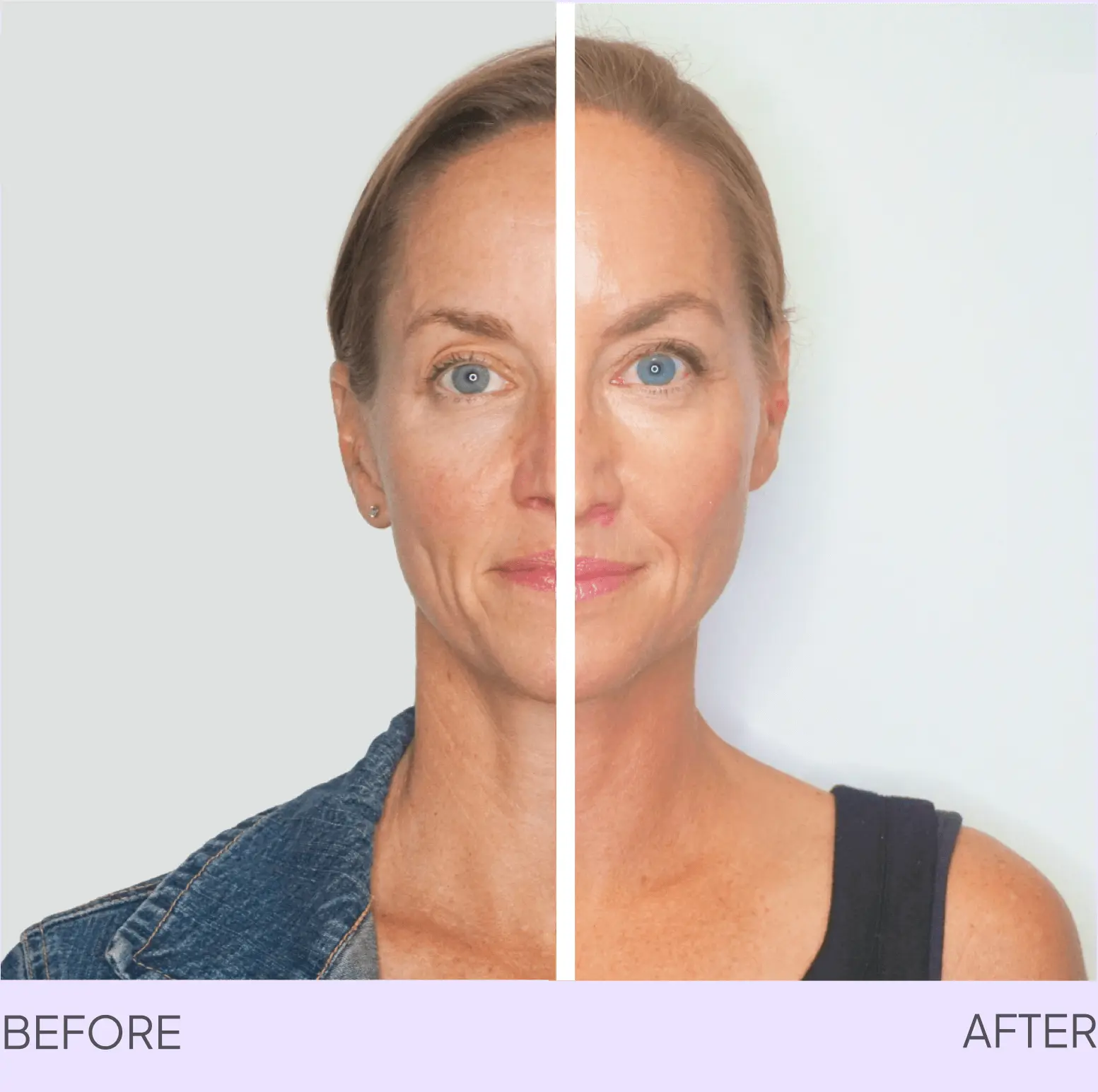 before and after image of a beautiful woman with refreshed and lifted skin after using microcurrent