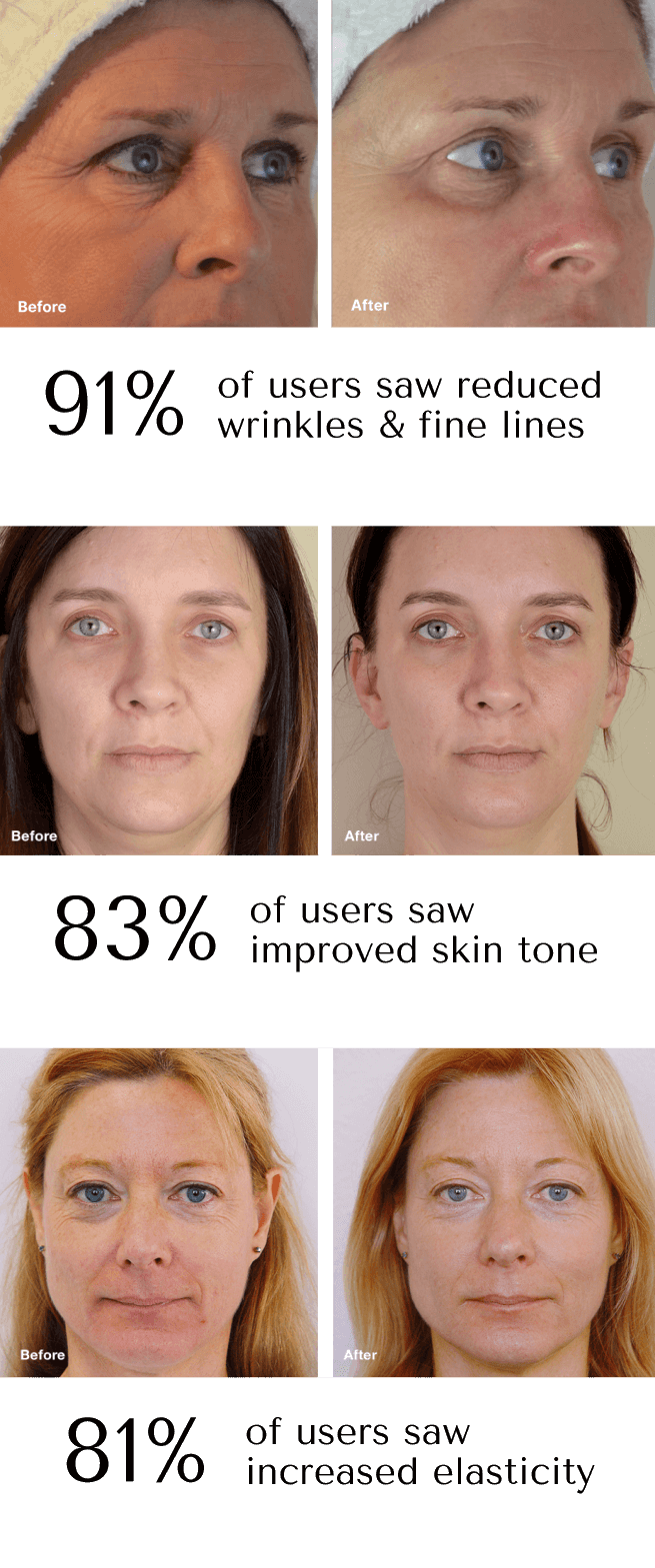 Myotone online Face Toning Tool