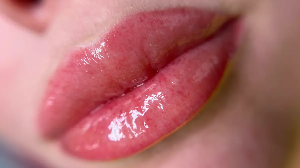 How to Get Naturally Fuller Lips at Home